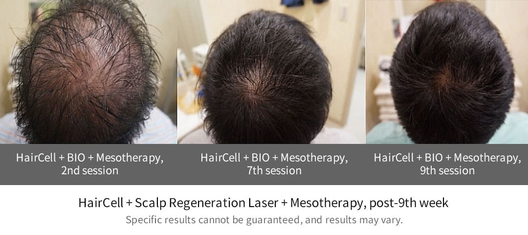 haircell photo
